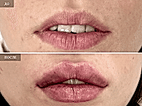 До/После фото 2 - 