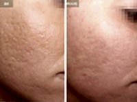 До/После фото 4 - 