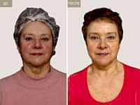 До/После фото 2 - 