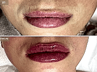 До/После фото 2 - 