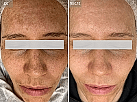 До/После фото 1 - 