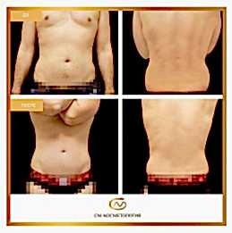 Фотогалерея фото 2 - 