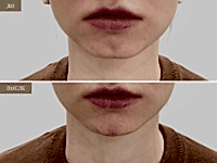 До/После фото 2 - 