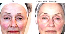 Фотогалерея фото 4 -