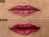 До/После фото 2 - 