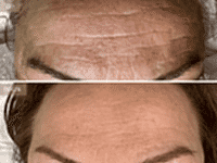 До/После фото 2 - 