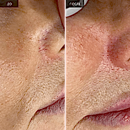 Фотогалерея фото 4 -