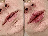 До/После фото 2 - 