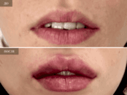 Фотогалерея фото 2 - 