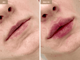 Фотогалерея фото 2 - 