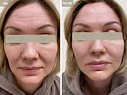 Фотогалерея фото 4 - 