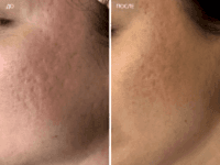 До/После фото 4 - 