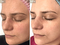 До/После фото 1 - 