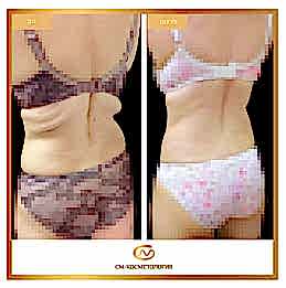 Фотогалерея фото 2 - 