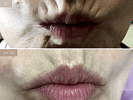 Фотогалерея фото 2 - 