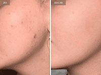 До/После фото 2 - 