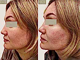 Фотогалерея фото 4 - 