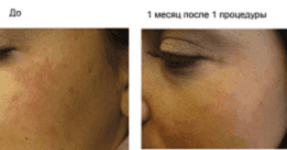 Фотогалерея фото 4 -