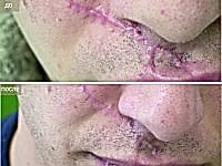 До/После фото 3 - 