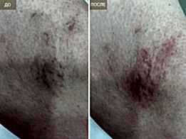 Фотогалерея фото 4 -