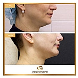 Фотогалерея фото 2 - 