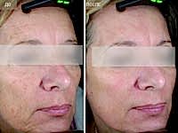 До/После фото 4 - 