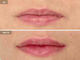 Фотогалерея фото 2 - 