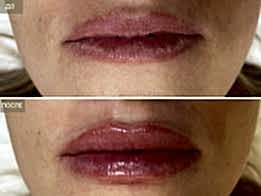 Фотогалерея фото 2 - 