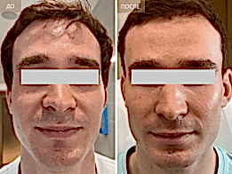 Фотогалерея фото 4 - 