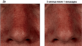 Фотогалерея фото 4 -