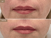 До/После фото 2 - 