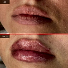 Фотогалерея фото 2 - 