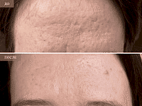 До/После фото 2 - 