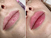 До/После фото 2 - 