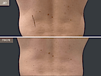 До/После фото 2 - 