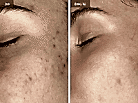 До/После фото 2 - 