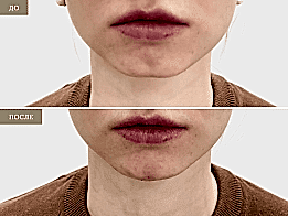 Фотогалерея фото 2 - 