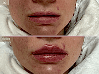 До/После фото 2 - 