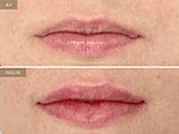 До/После фото 2 - 