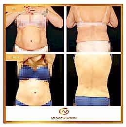 Фотогалерея фото 2 - 