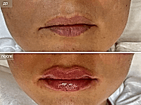 До/После фото 2 - 