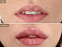 До/После фото 2 - 