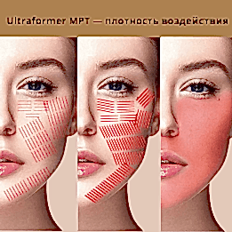 Фотогалерея фото 1 -