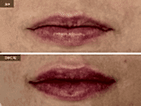 До/После фото 2 - 