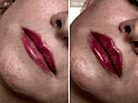 До/После фото 2 - 