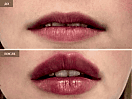 Фотогалерея фото 2 - 