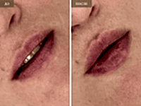 До/После фото 2 - 